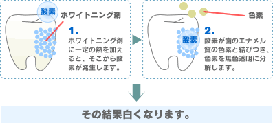 歯が白くなるメカニズム1