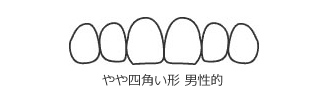 スクウェア