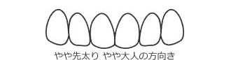 テーパー