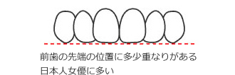 クローズ