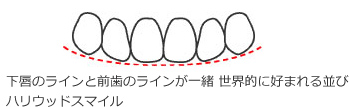スマイルライン