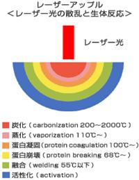レーザーアップル