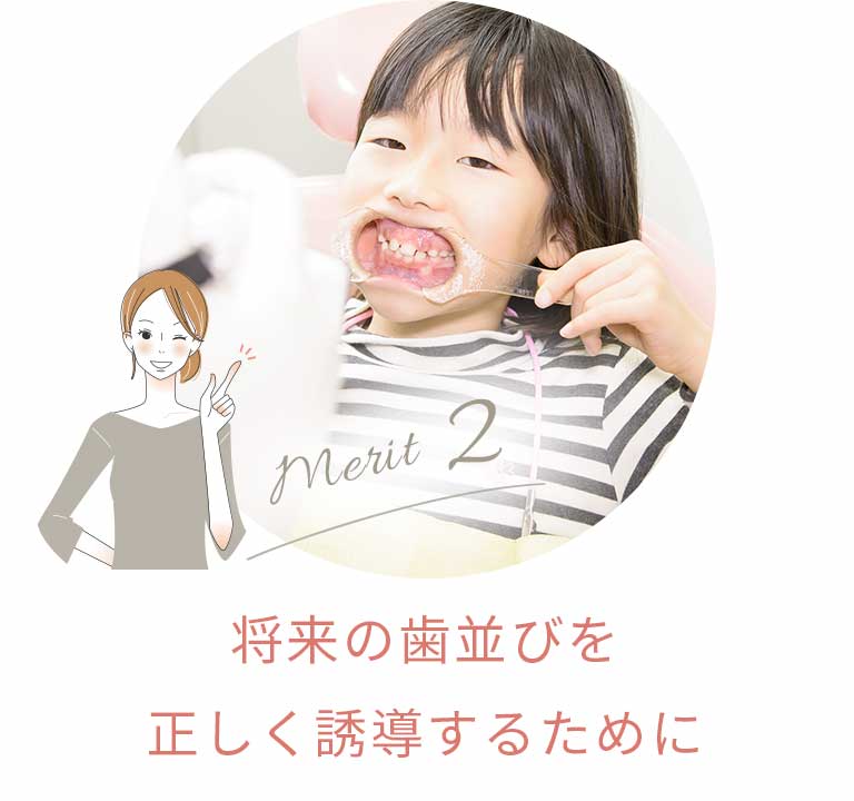 永久歯を正しい位置に誘導