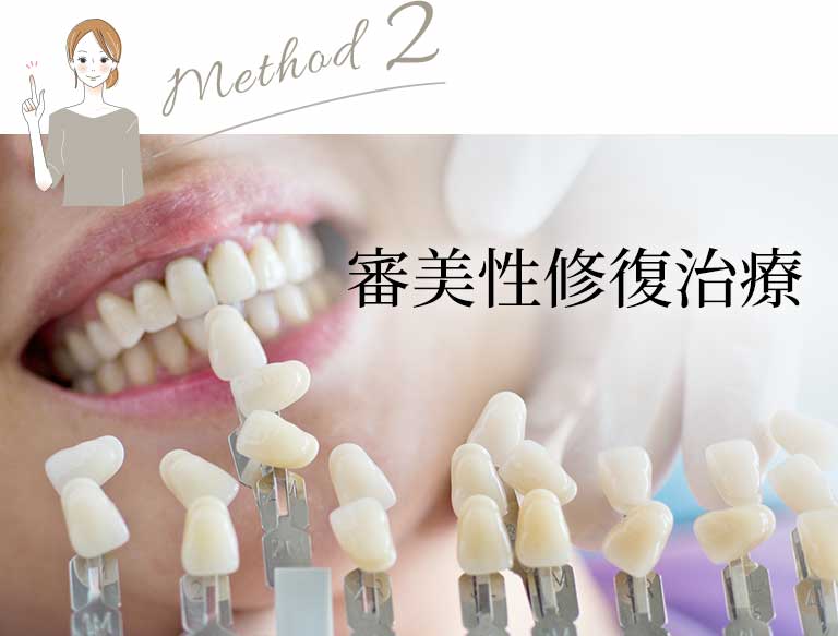 審美性修復治療