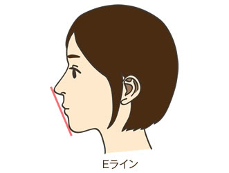 失敗とはどんなケース?