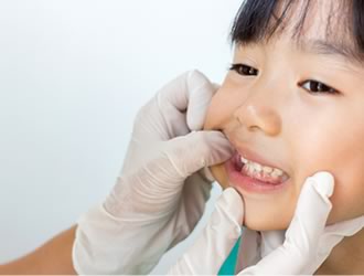 子どもの歯