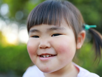 受け口と思われるこども